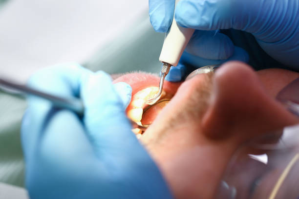 Best Dentist for Tooth Abscess  in Pleak, TX